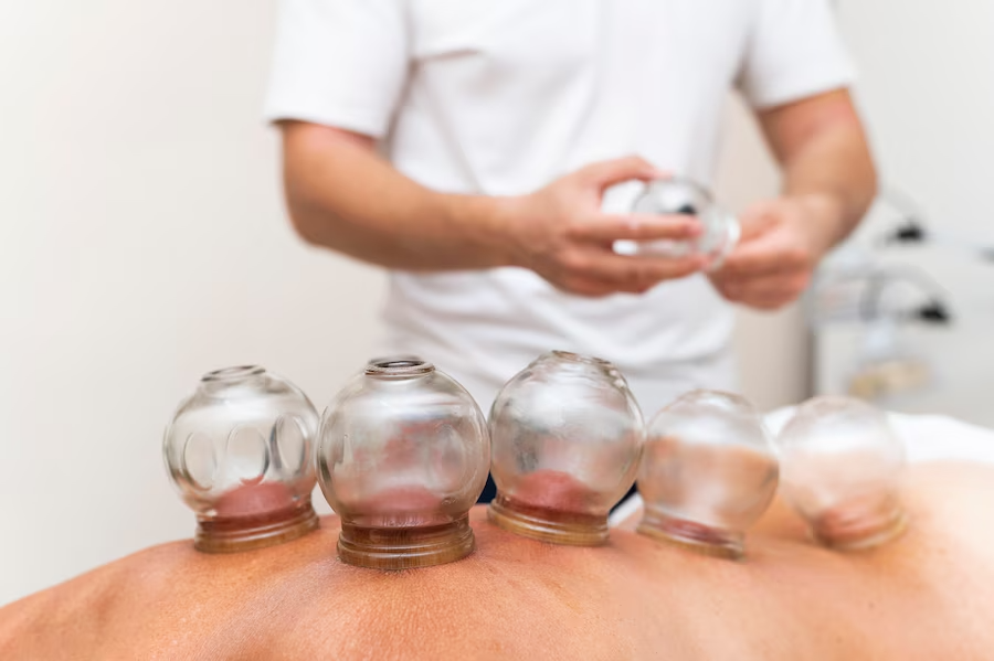 wet cupping therapy melbourne