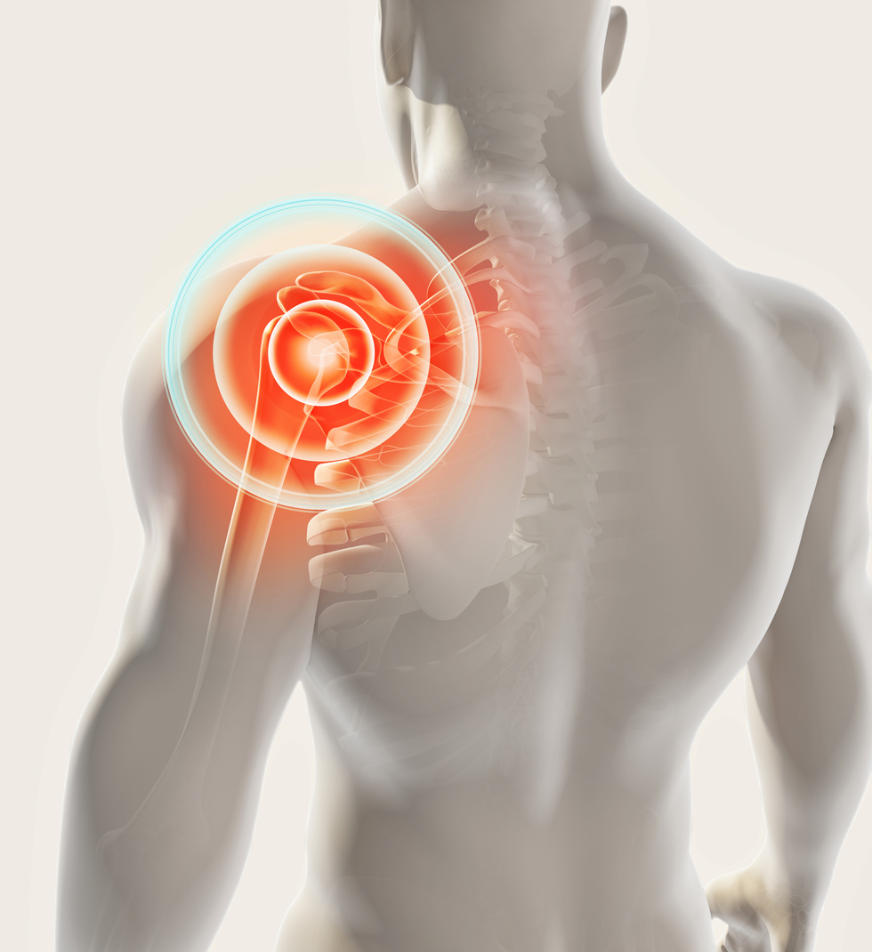 Shoulder pain